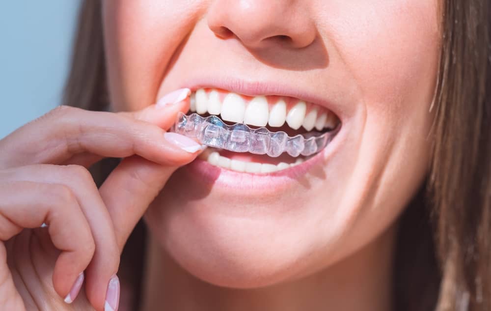 Aftercare is important for all orthodontic treatments, including Invisalign