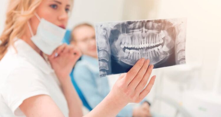 An x-ray can show if you have wisdom teeth