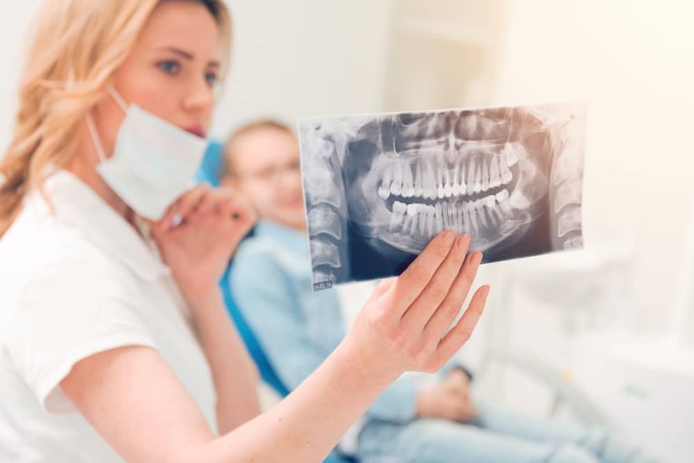 An x-ray can show if you have wisdom teeth