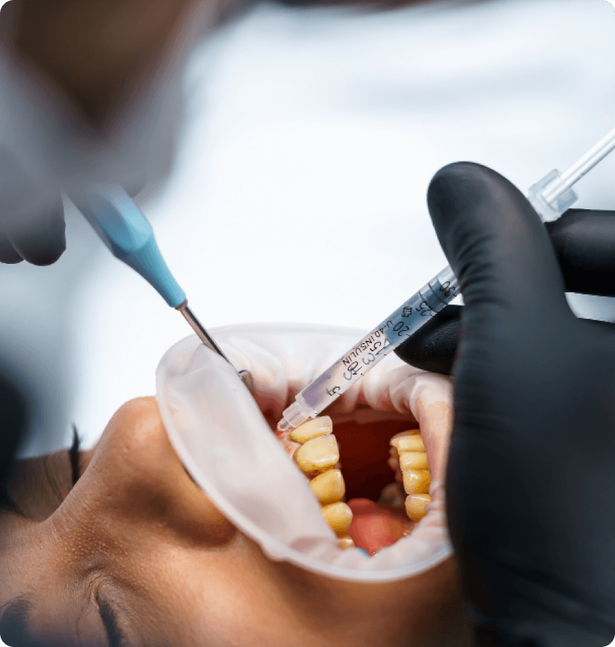 About sedation dentistry at 123 Dental