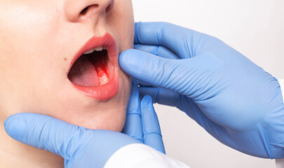 Person examining a knocked-out tooth